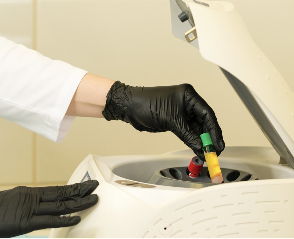 Platelet‑Rich Plasma (PRP) Joint Wellness
